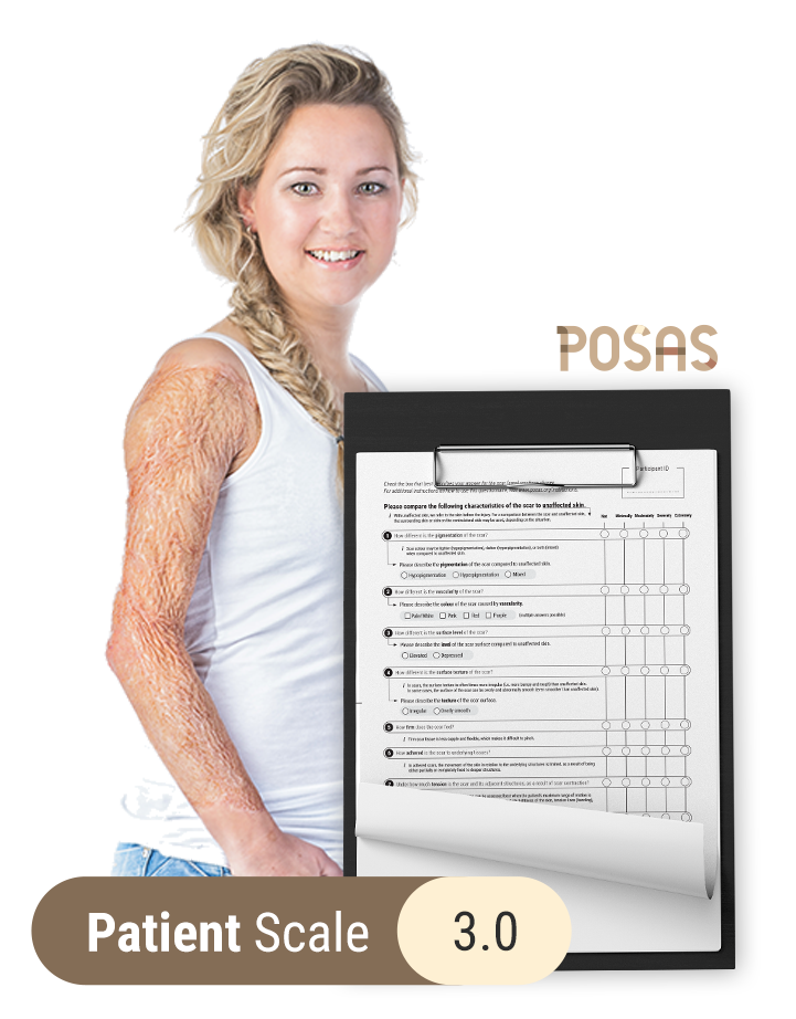 POSAS patient scale 3.0